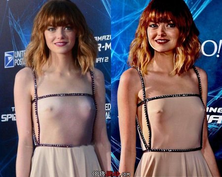 Emma Stone chest