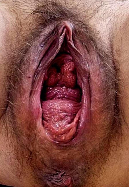 Big Hairy Vagina