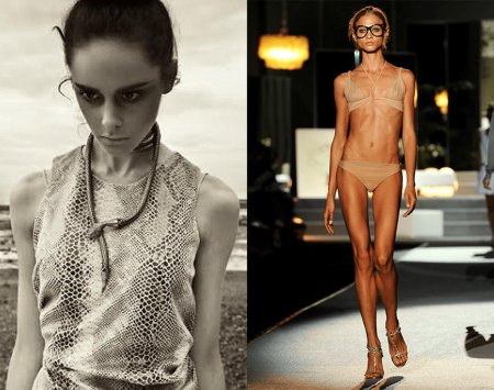 Pornstar anorexica