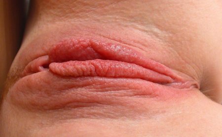 Labia with large Plan