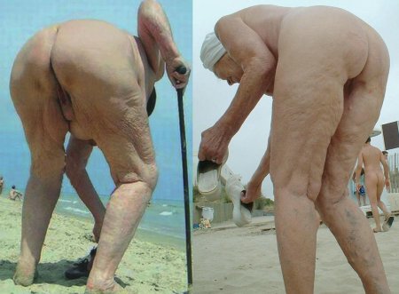 Burnts of naked old women on the beach