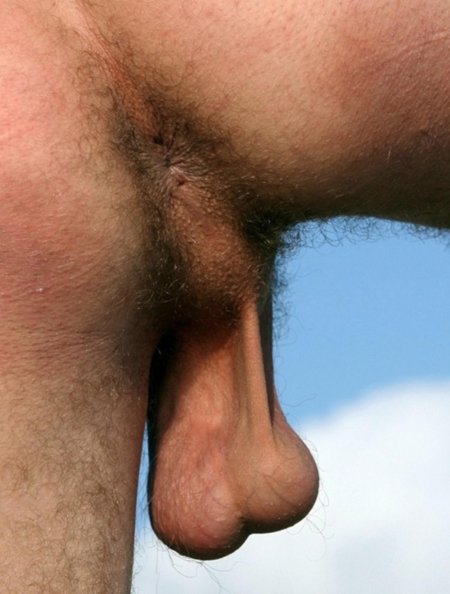 Huge hairy testicles